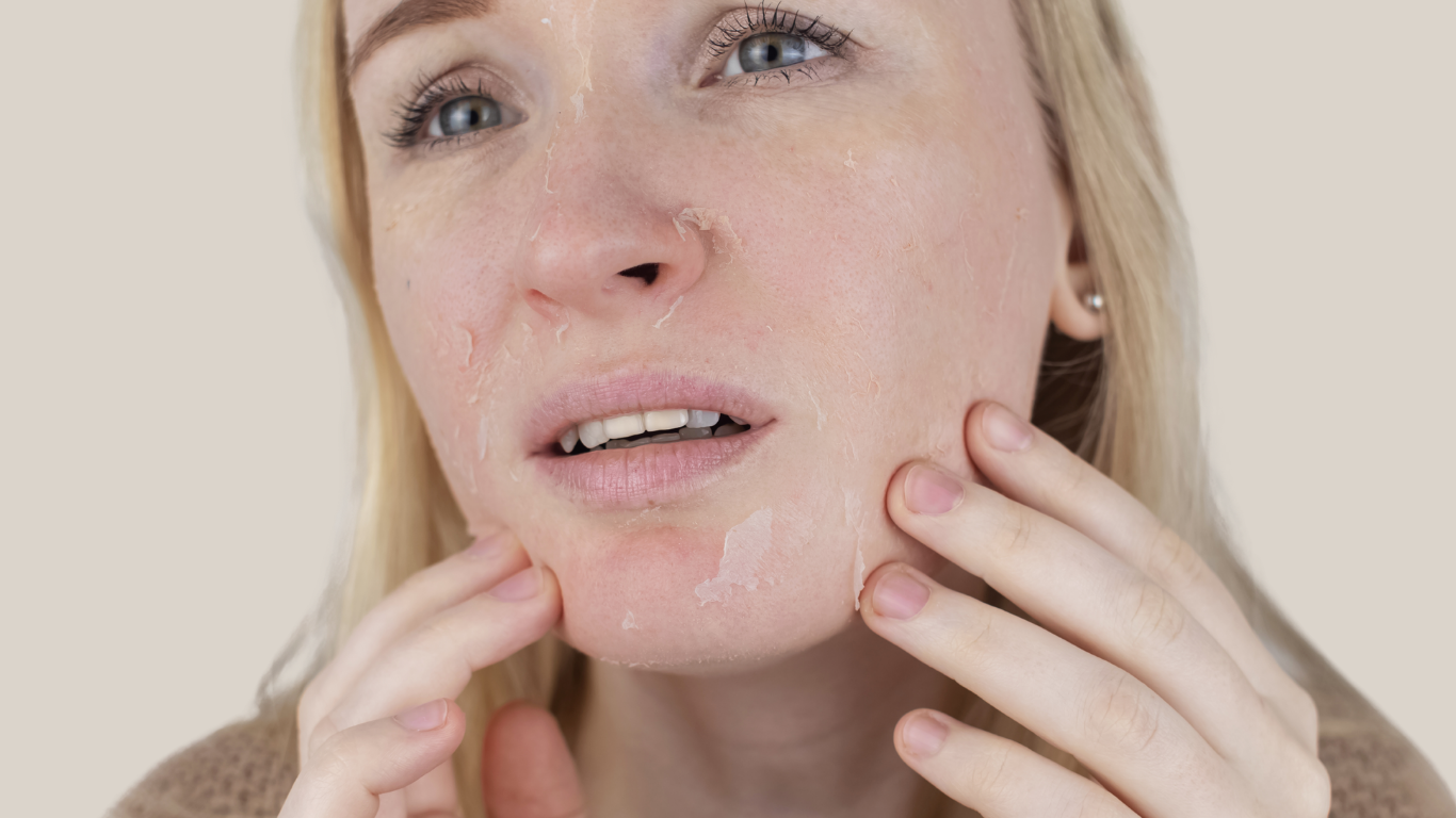 October is Eczema Awareness Month - Caring for Sensitive and Eczema-Prone Skin