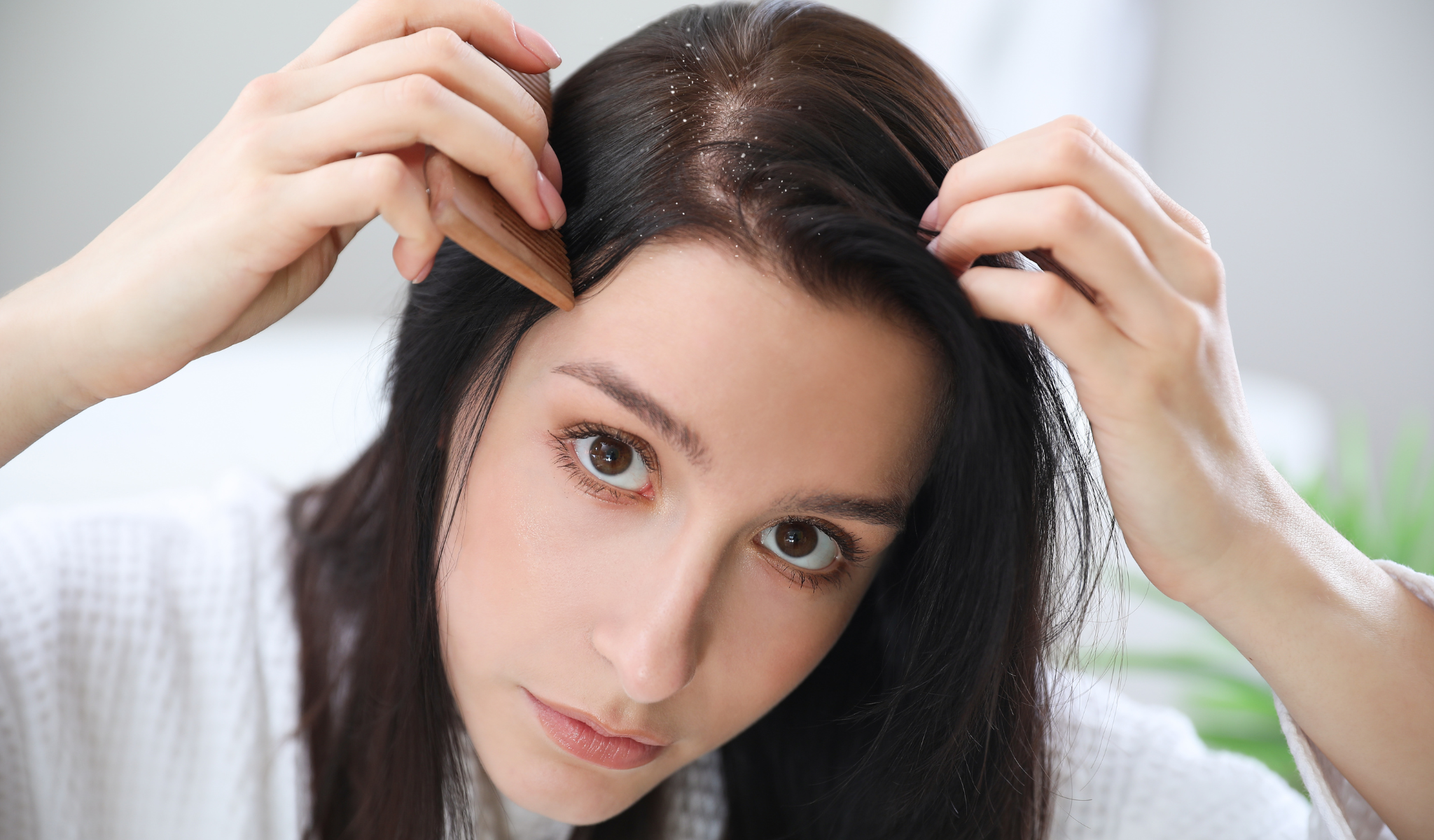 Ultimate Guide to Dry Scalp and Dandruff: Causes and Remedies